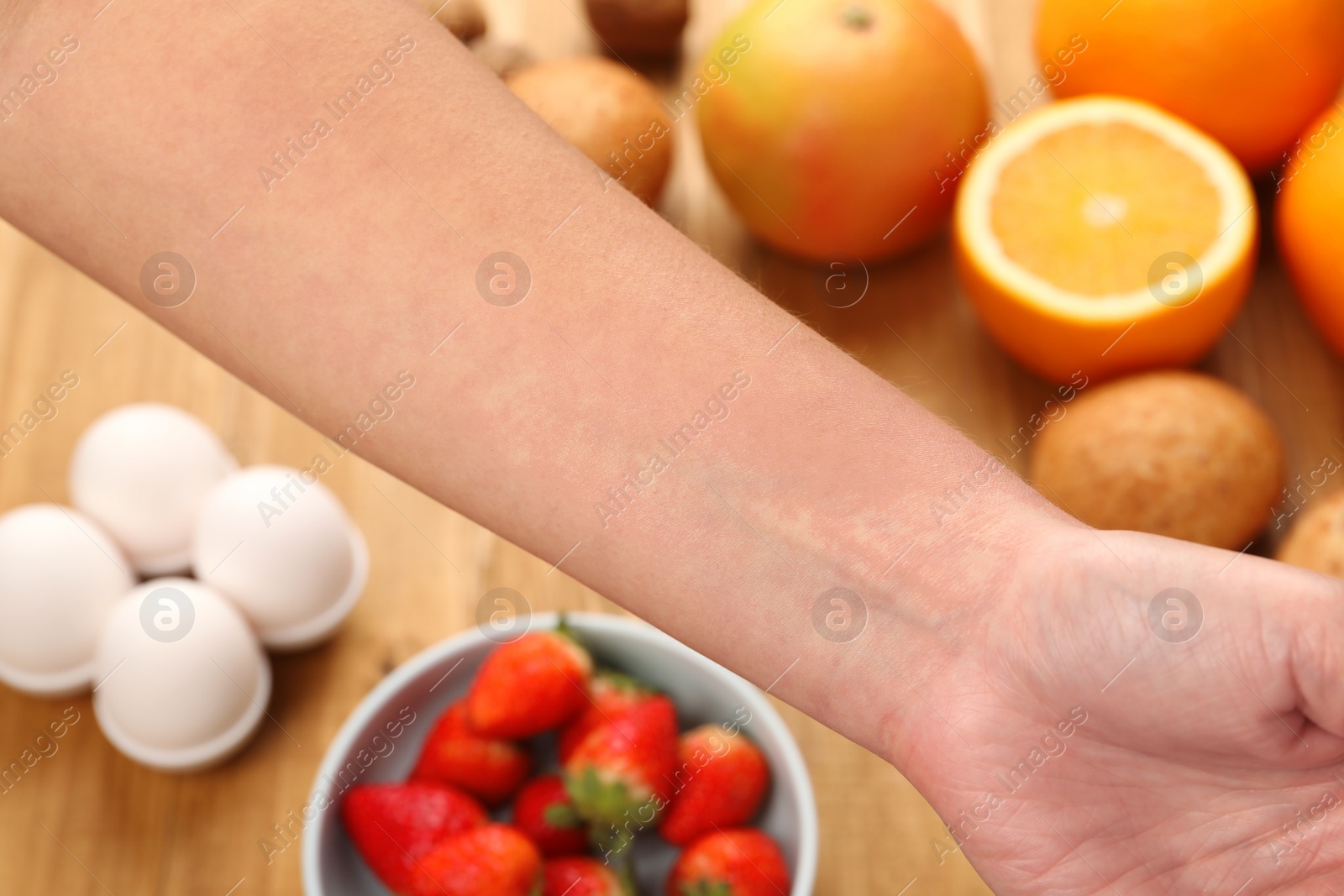 Photo of Food allergy. Woman holding hand over products on table, closeup