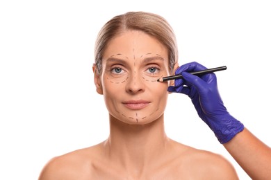 Doctor with pencil preparing patient for cosmetic surgery operation on white background