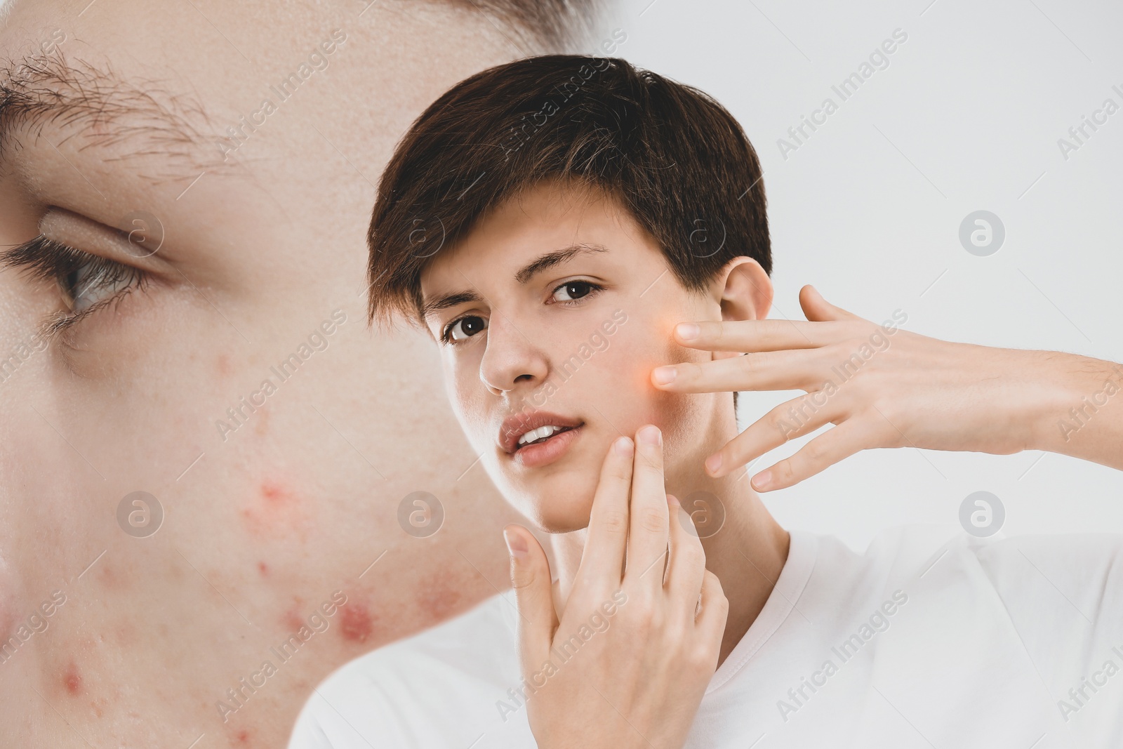 Image of Teenage boy suffering from acnephobia examining face. Vision of person with problem skin