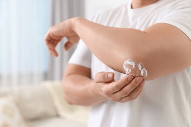 Photo of Man applying body cream onto his elbow at home, closeup