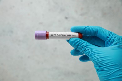 Laboratory worker holding tube with blood sample and label Liver Function Test against light background, closeup