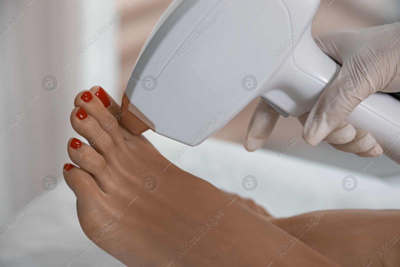 Photo of Woman undergoing laser epilation procedure, closeup view