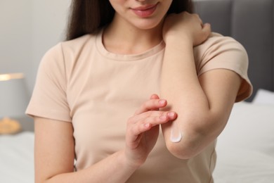 Photo of Young woman with dry skin applying cream onto her elbow indoors, closeup