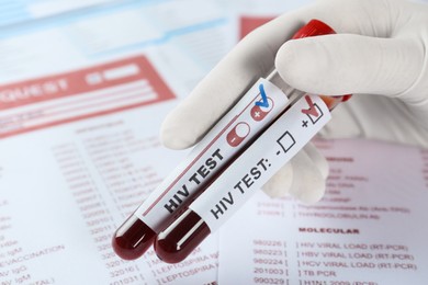 Photo of Scientist holding tubes with blood samples and labels HIV Test against laboratory forms, closeup