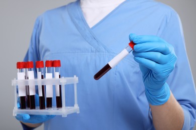 Photo of Laboratory testing. Doctor with blood samples in tubes on light grey background