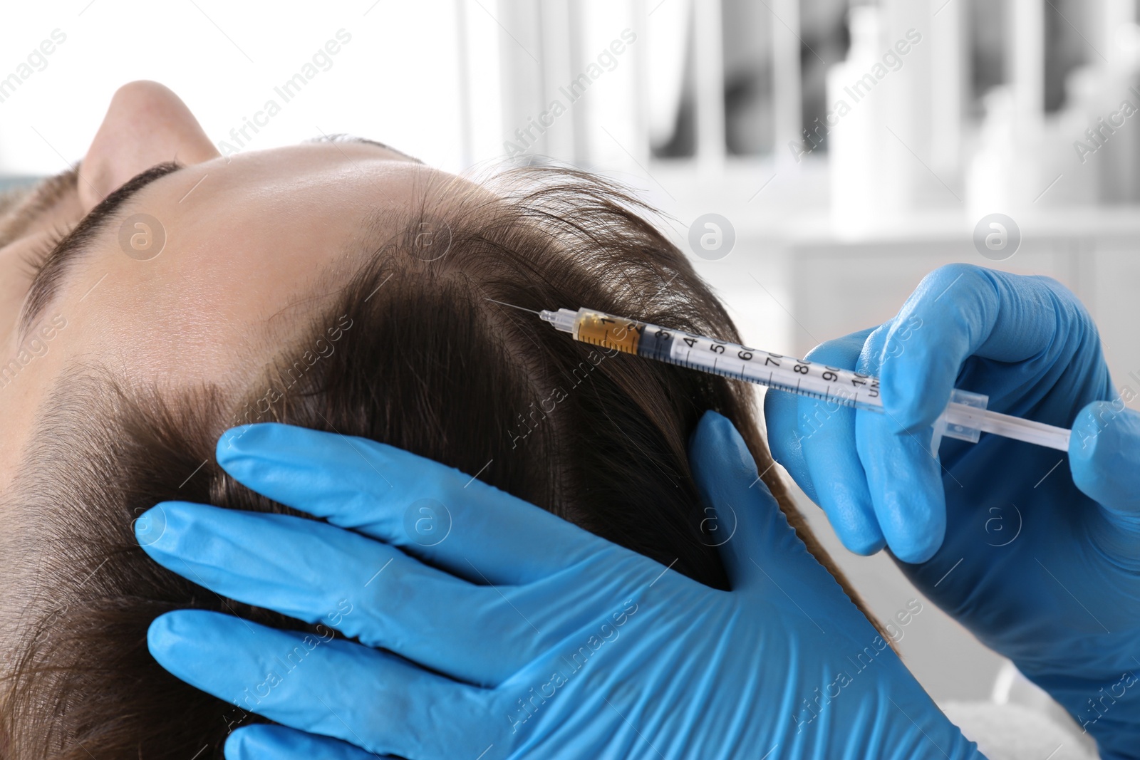 Photo of Young man with hair loss problem receiving injection in salon, closeup