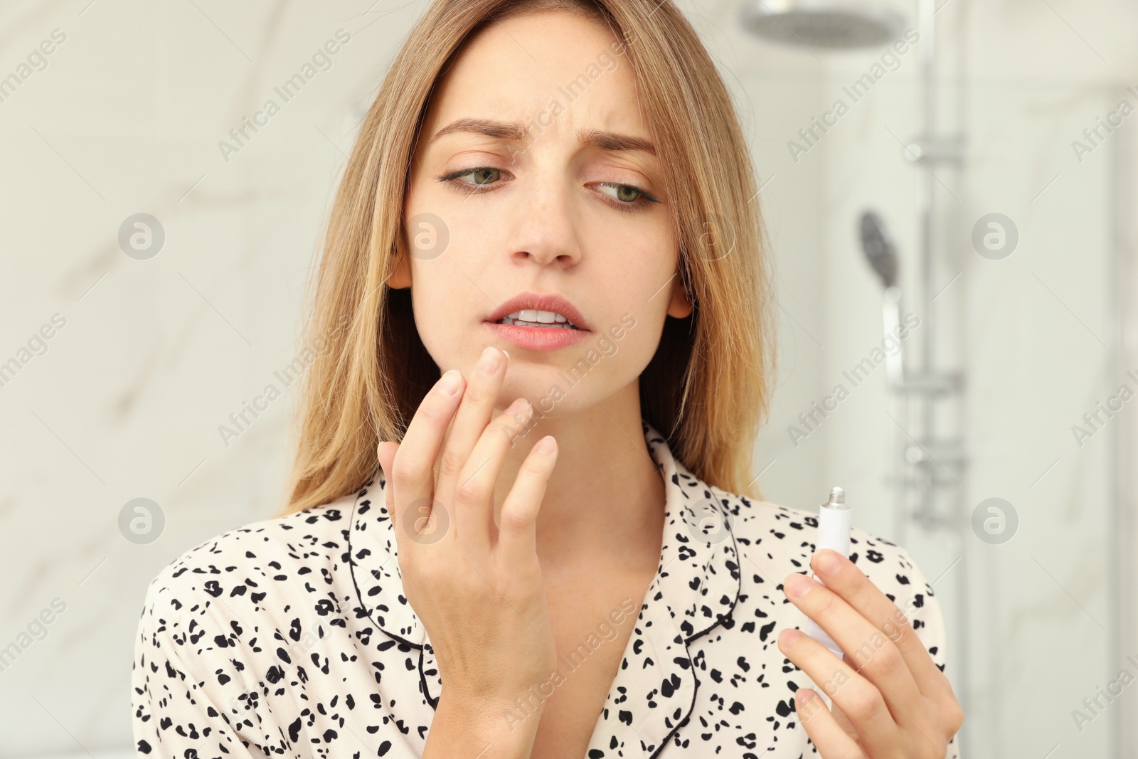 Photo of Woman with herpes applying cream onto lip in bathroom