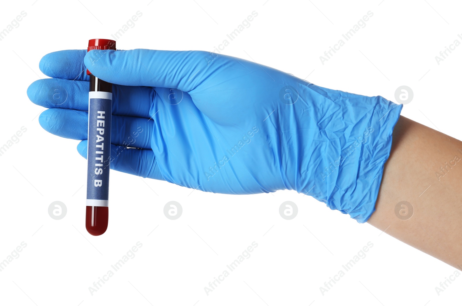 Photo of Scientist holding tube with blood sample and label Hepatitis B on white background, closeup