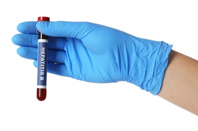 Photo of Scientist holding tube with blood sample and label Hepatitis B on white background, closeup