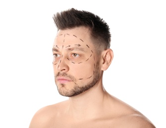 Photo of Man with marks on face for cosmetic surgery operation against white background