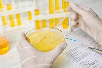 Laboratory worker taking urine sample from dish at table, closeup. Urology concept