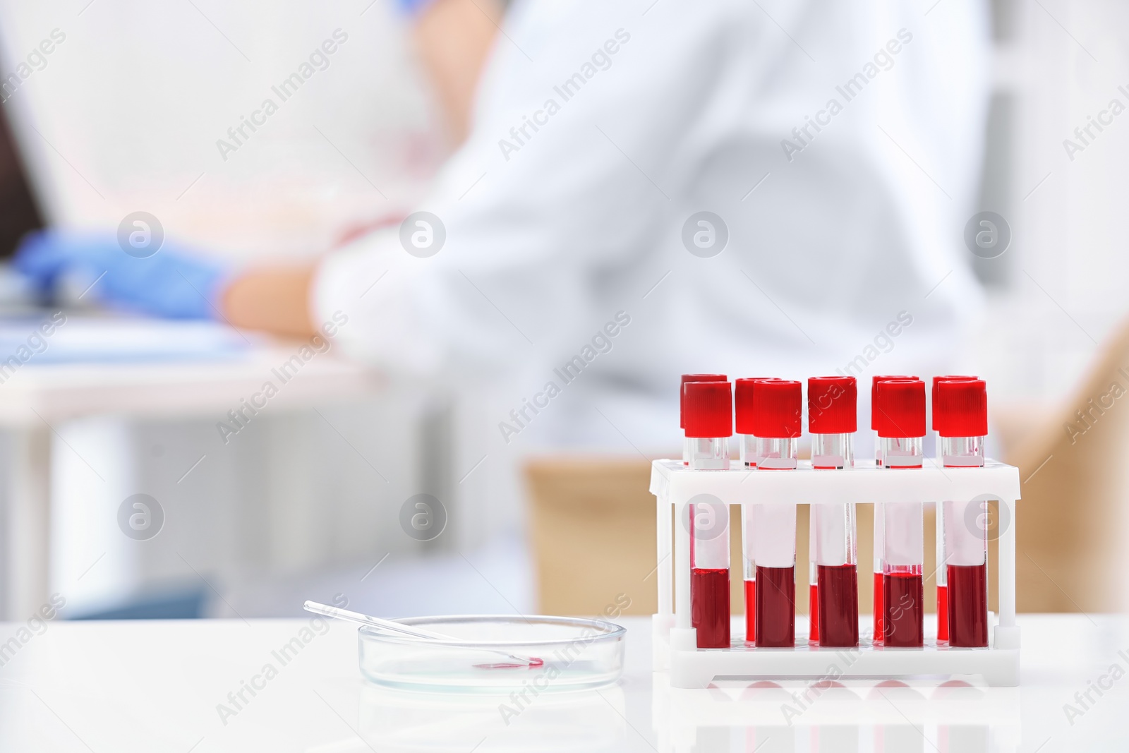 Photo of Test tubes with blood samples and scientist working on computer in laboratory