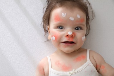 Cute little baby with anti-allergic cream on her face in crib, top view and space for text. Redness on skin