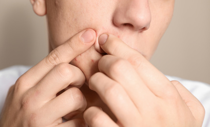 Photo of Teen guy with acne problem squeezing pimple on beige background, closeup