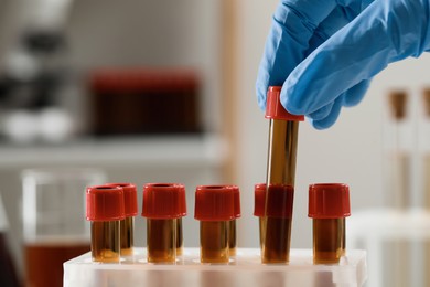 Photo of Scientist putting test tube with brown liquid into stand, closeup
