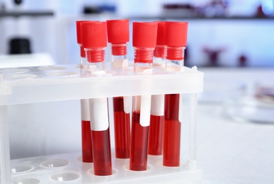 Test tubes with blood samples for analysis on table in laboratory, closeup