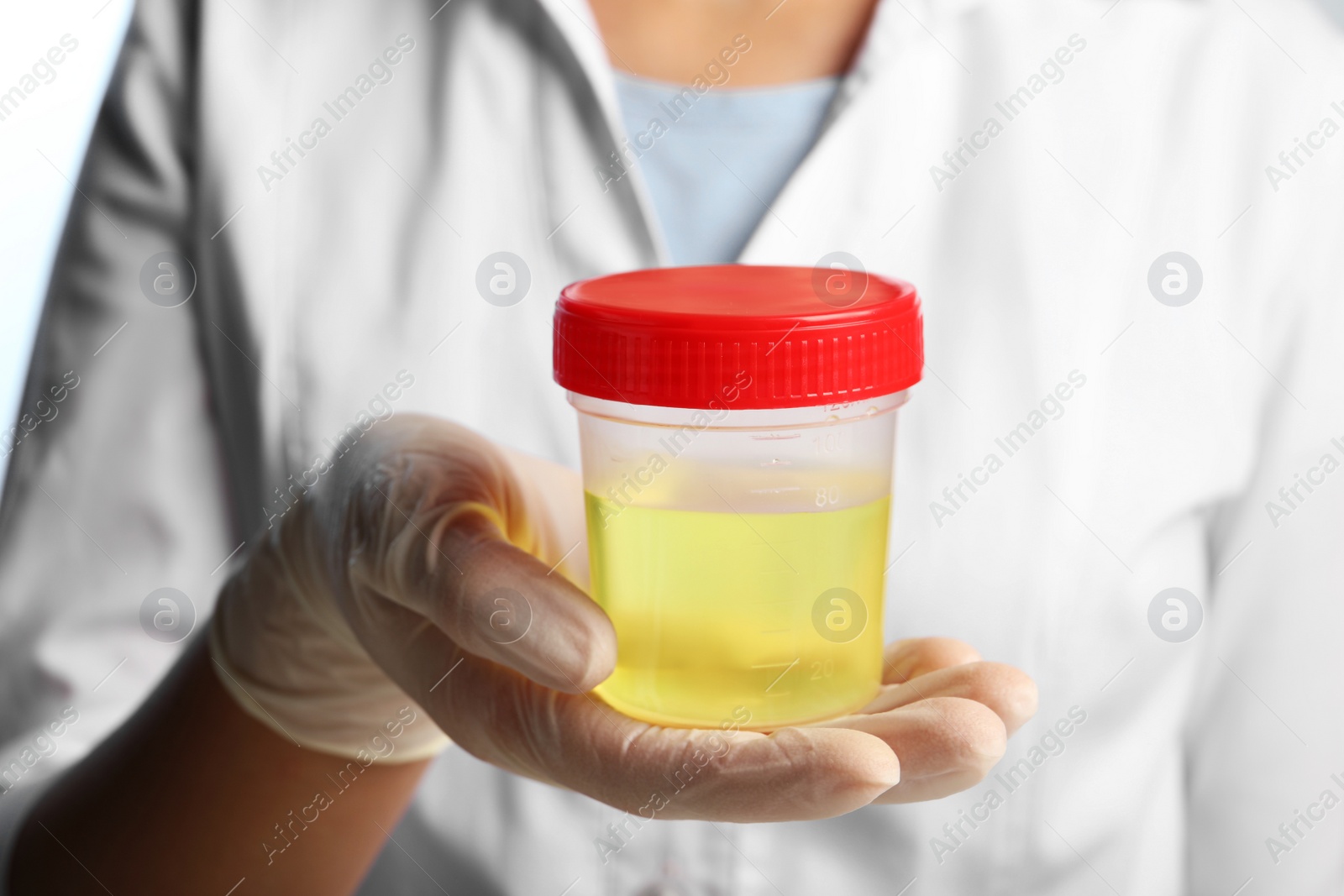 Photo of Doctor holding container with urine sample for analysis, closeup