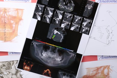 Photo of Panoramic x-ray and dental anatomy charts as background, top view