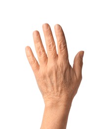 Photo of Closeup view of woman's hand with aging skin