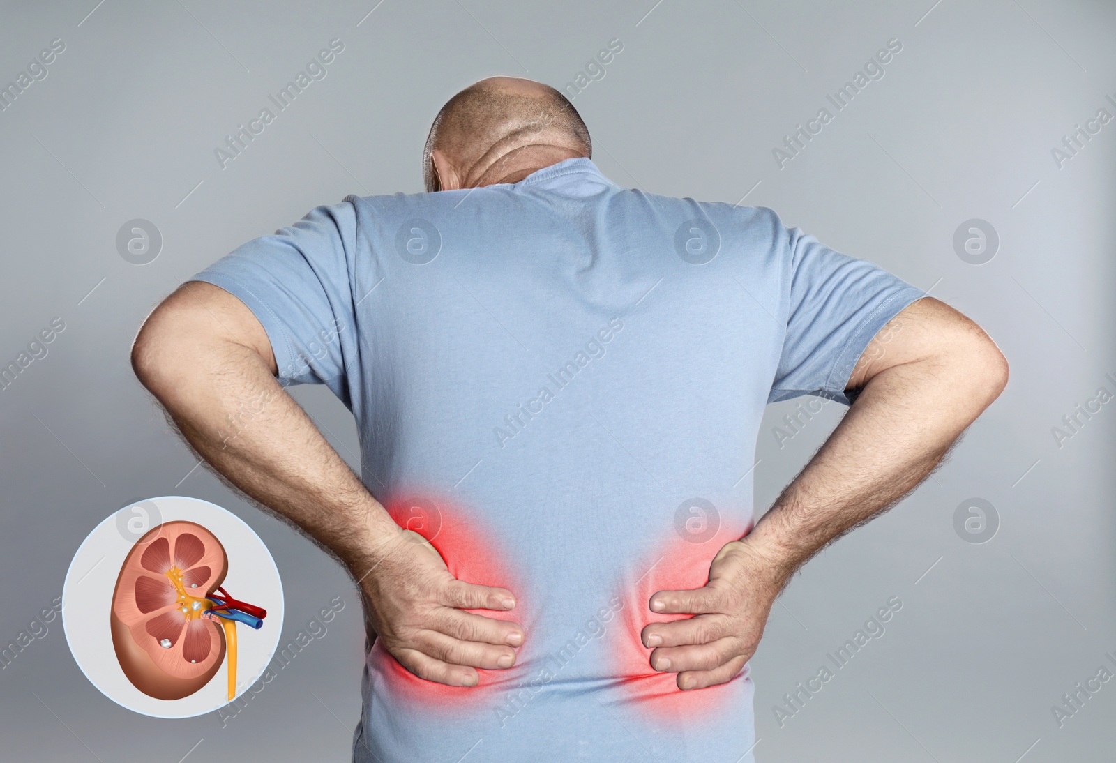 Image of Senior man suffering from pain because of kidney stones disease on grey background