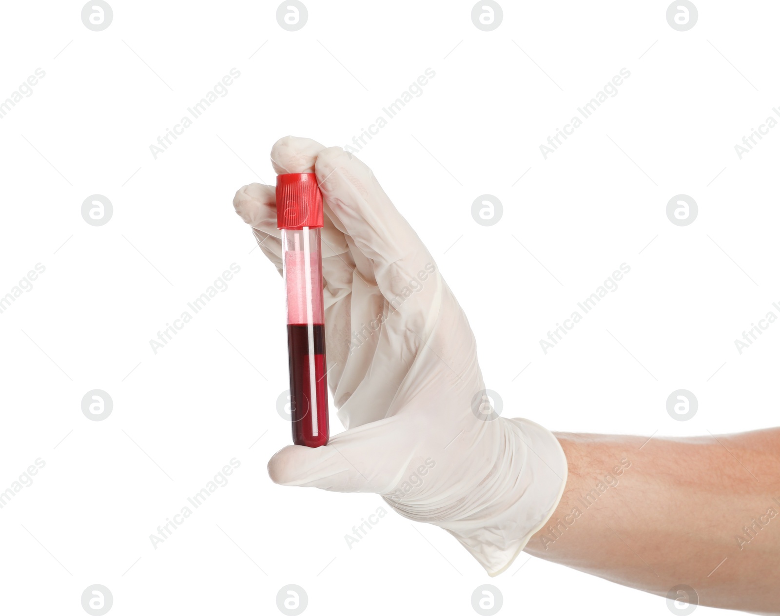 Photo of Male doctor holding test tube with blood sample on white background, closeup. Medical object