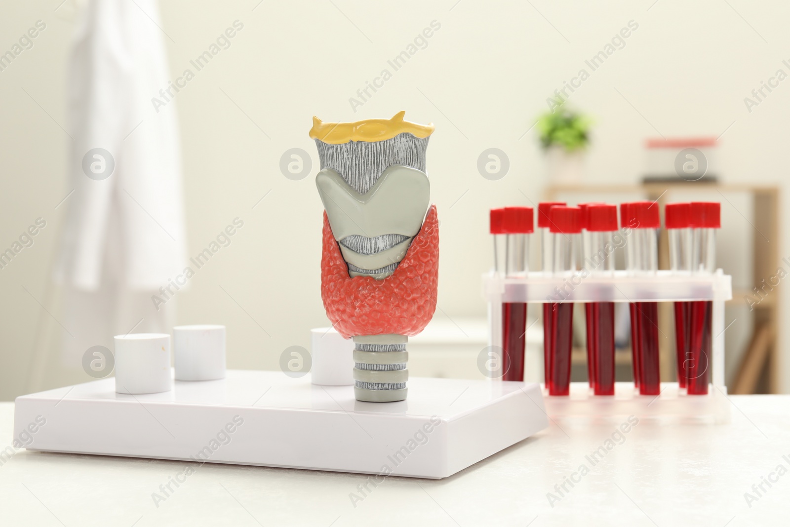 Photo of Endocrinology. Model of thyroid gland and samples of blood in test tubes on white table at clinic