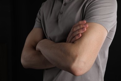 Photo of Man with space for tattoo on his arms against black background, closeup