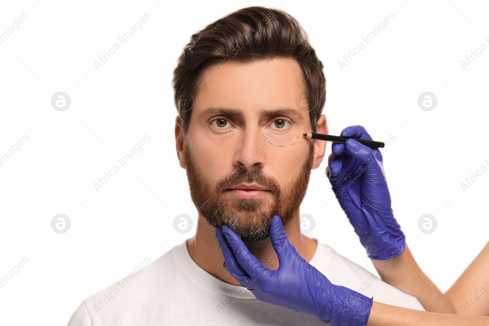 Photo of Doctor with pencil preparing patient for cosmetic surgery operation on white background