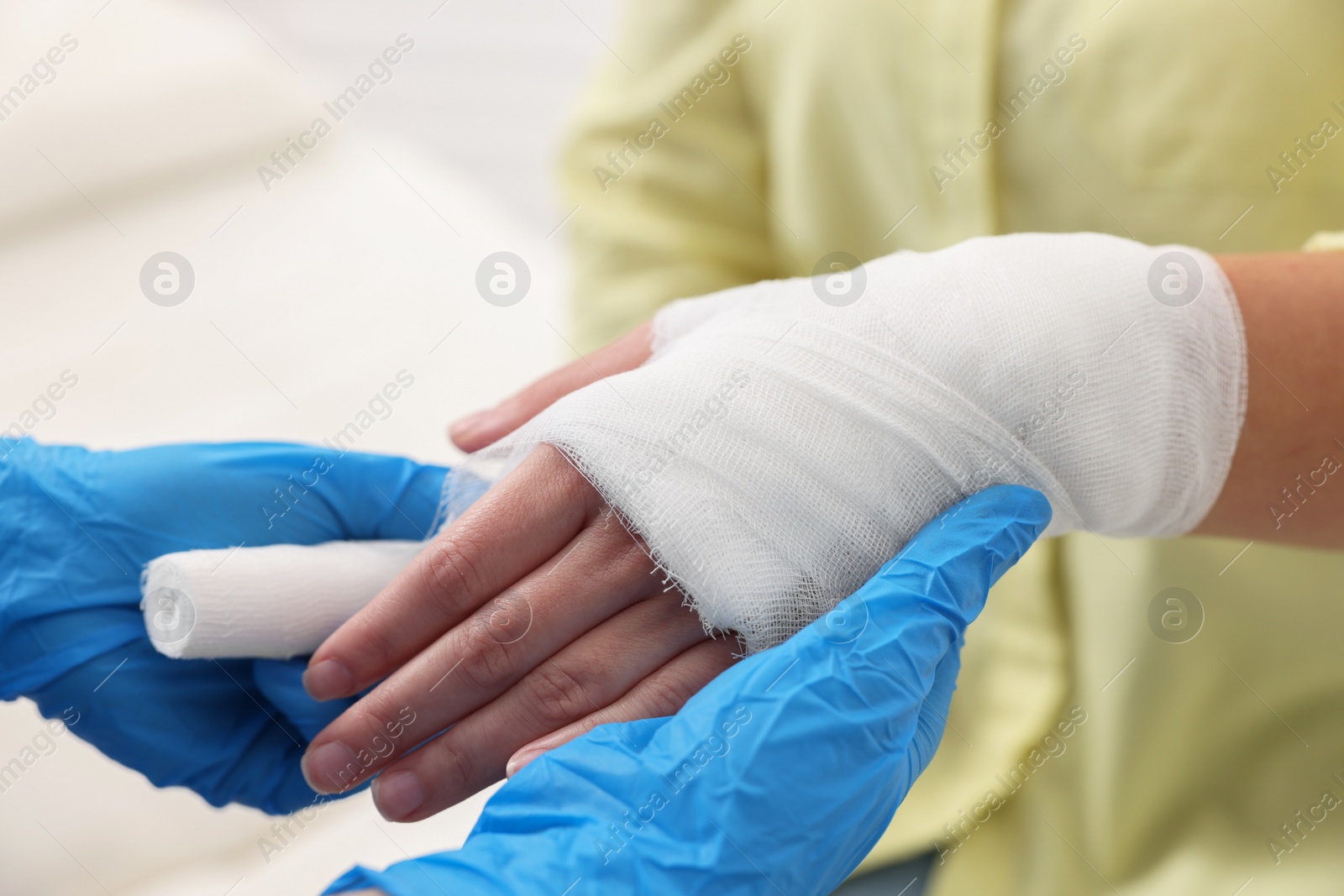 Photo of Doctor bandaging patient's burned hand indoors, closeup