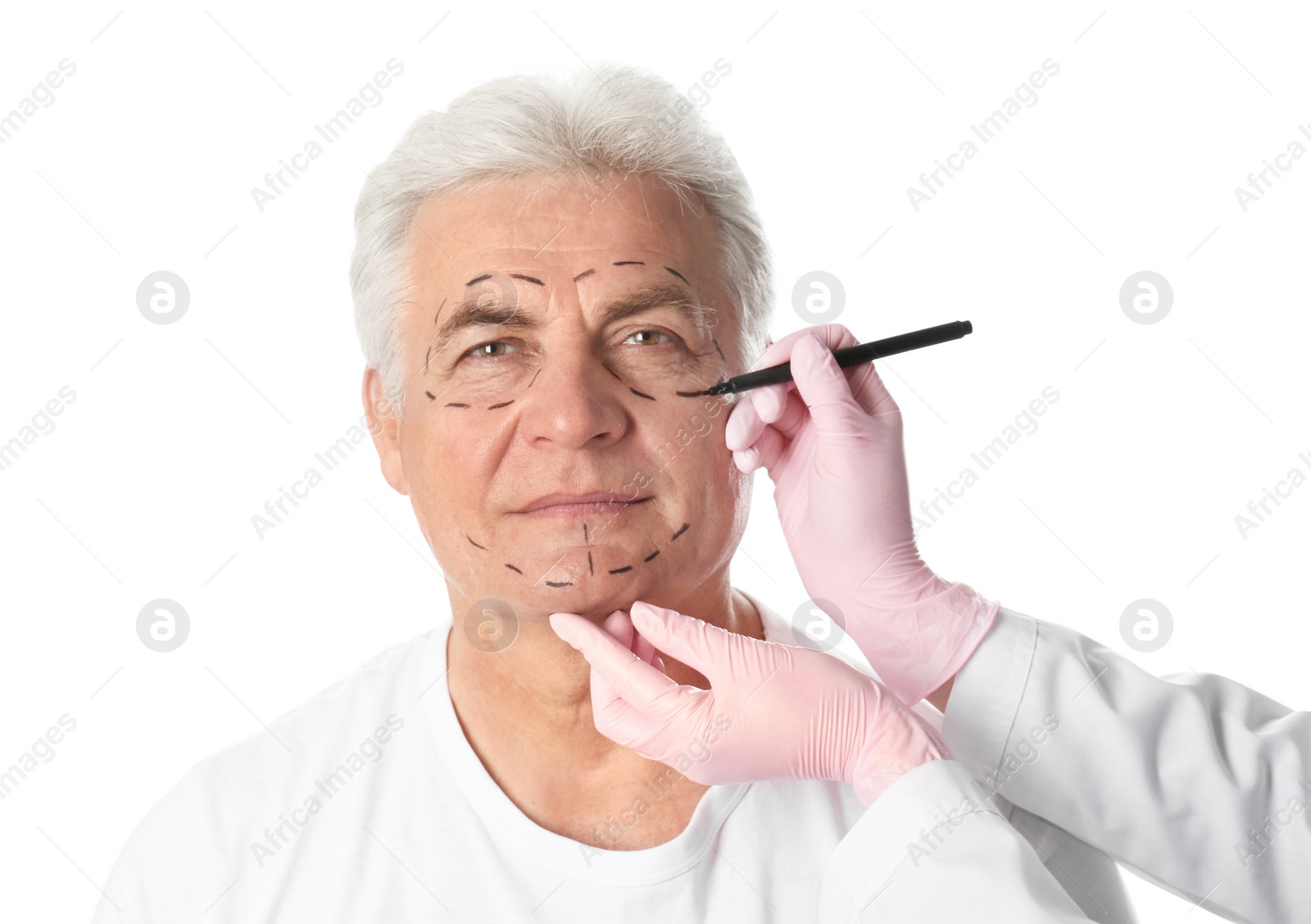 Photo of Doctor drawing marks on mature man's face for cosmetic surgery operation against white background