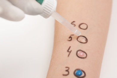 Patient undergoing skin allergy test at light table, closeup