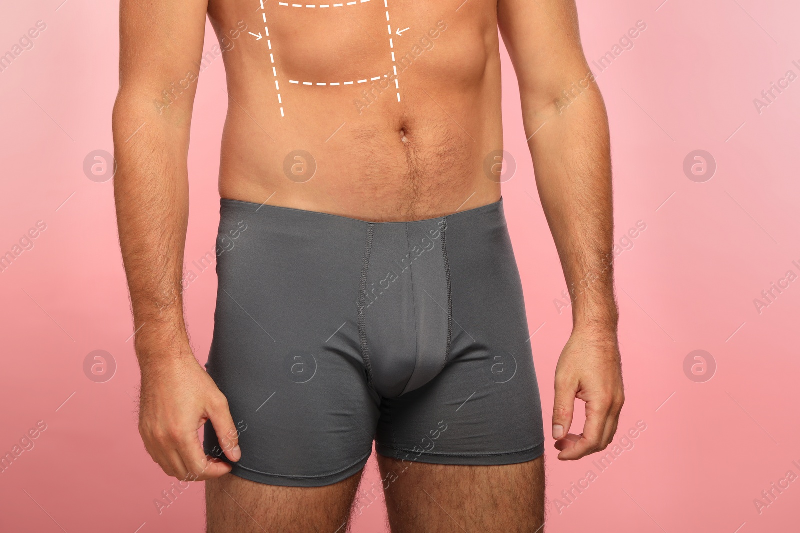 Image of Man with markings for cosmetic surgery on his abdomen against pink background, closeup