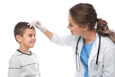 Photo of Doctor applying cream onto skin of little boy with chickenpox on white background. Varicella zoster virus