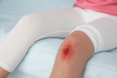 Little girl with injured leg in clinic, closeup. First aid