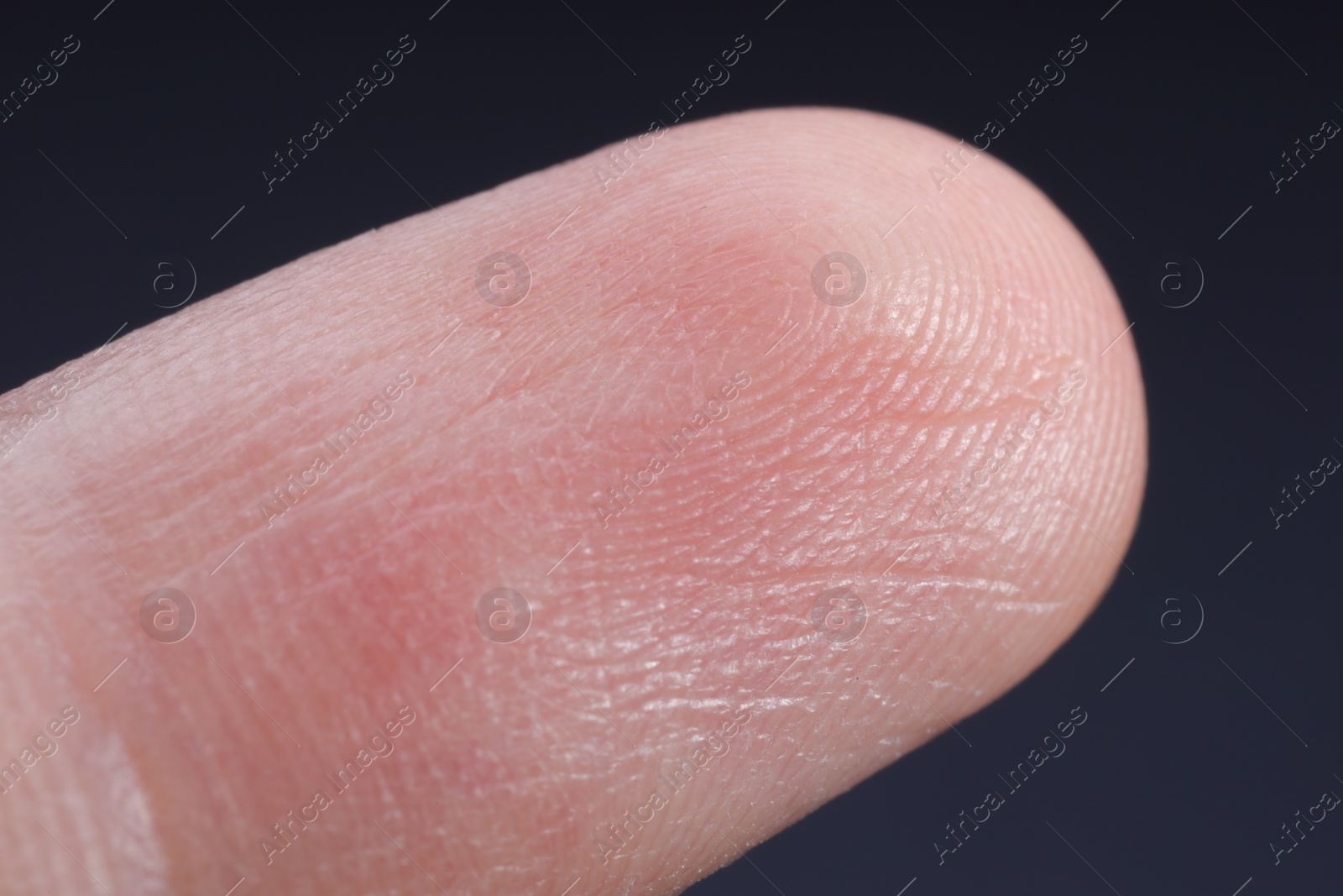 Photo of Finger with friction ridges on dark background, macro view