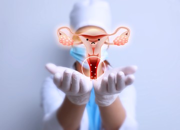 Image of Doctor demonstrating virtual image of infected female reproductive system on light background, closeup. Vaginal candidiasis