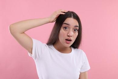 Emotional woman suffering from dandruff problem on pink background