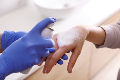 Photo of Applying burn spray onto injured skin, closeup