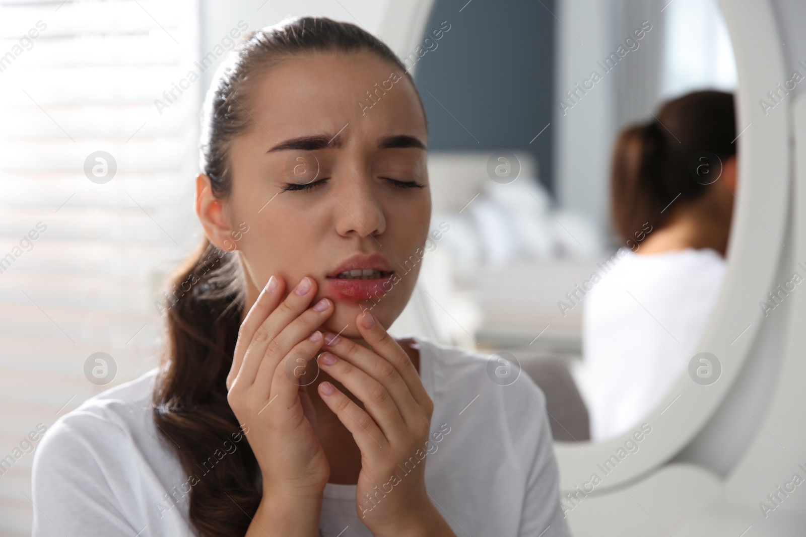 Photo of Young woman with herpes on lip at home