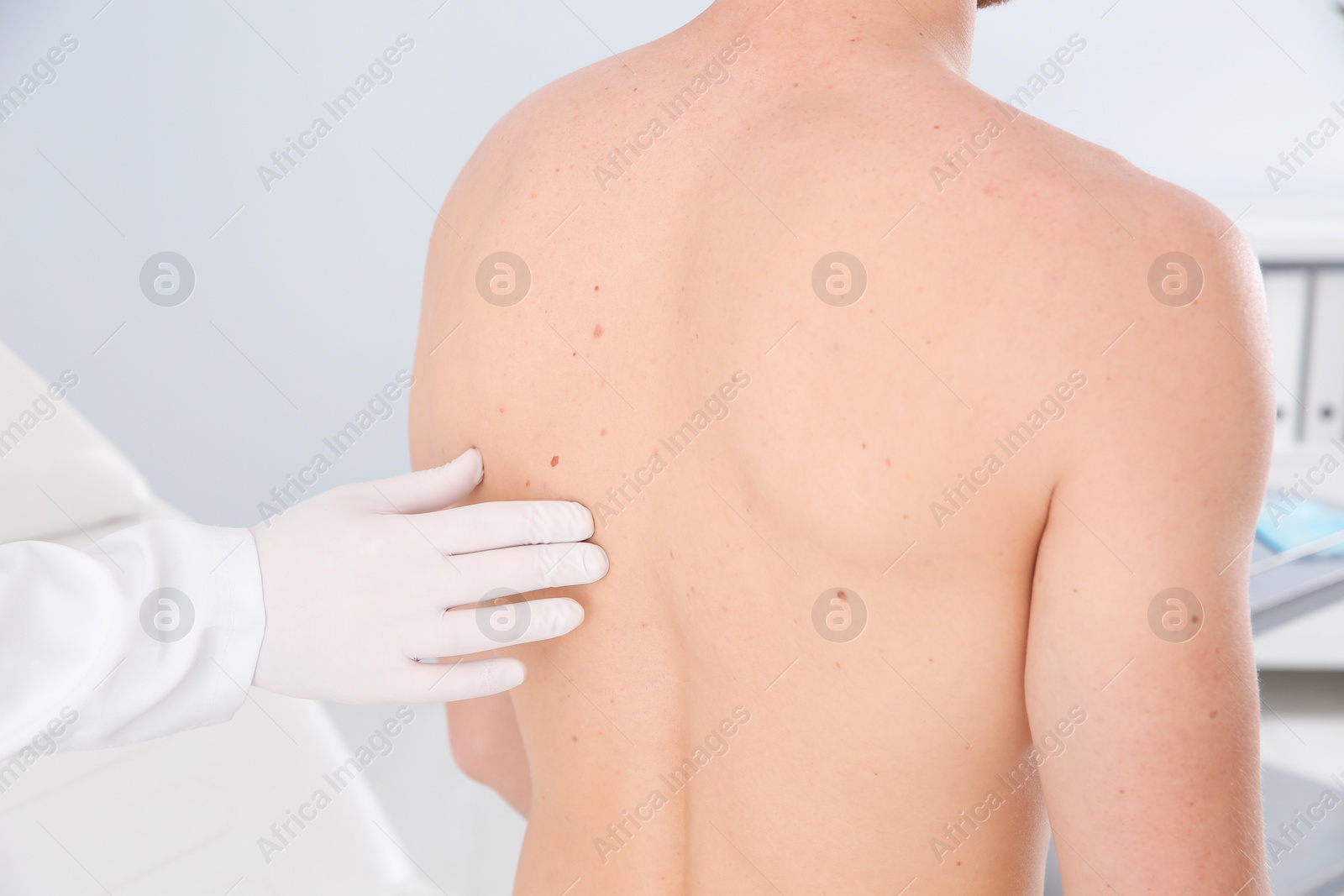 Photo of Dermatologist examining patient's birthmark in clinic, closeup