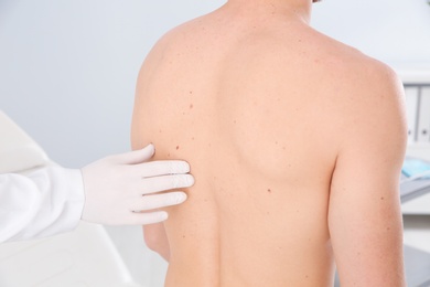 Photo of Dermatologist examining patient's birthmark in clinic, closeup