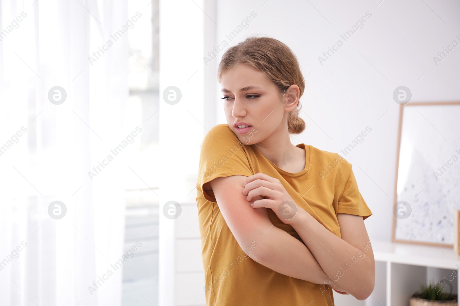 Photo of Woman scratching arm indoors, space for text. Allergy symptoms