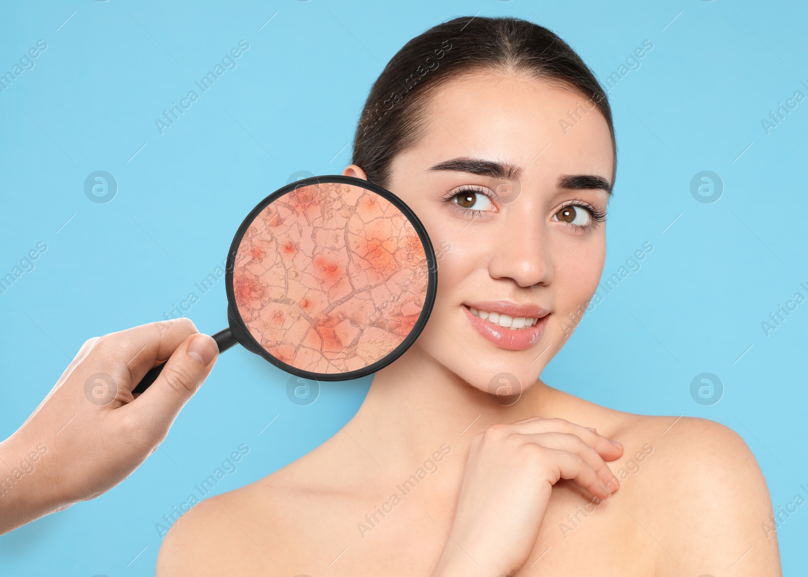 Image of Young woman with facial dry skin problem on light blue background