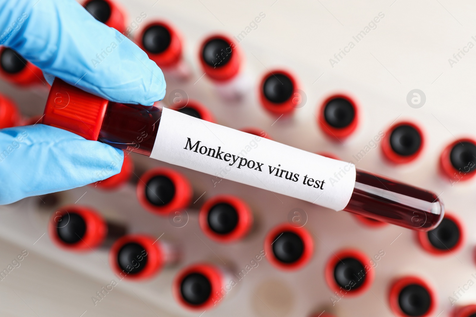 Photo of Laboratory worker holding test tube with blood sample over rack, closeup