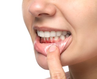 Woman showing healthy gums on white background, closeup