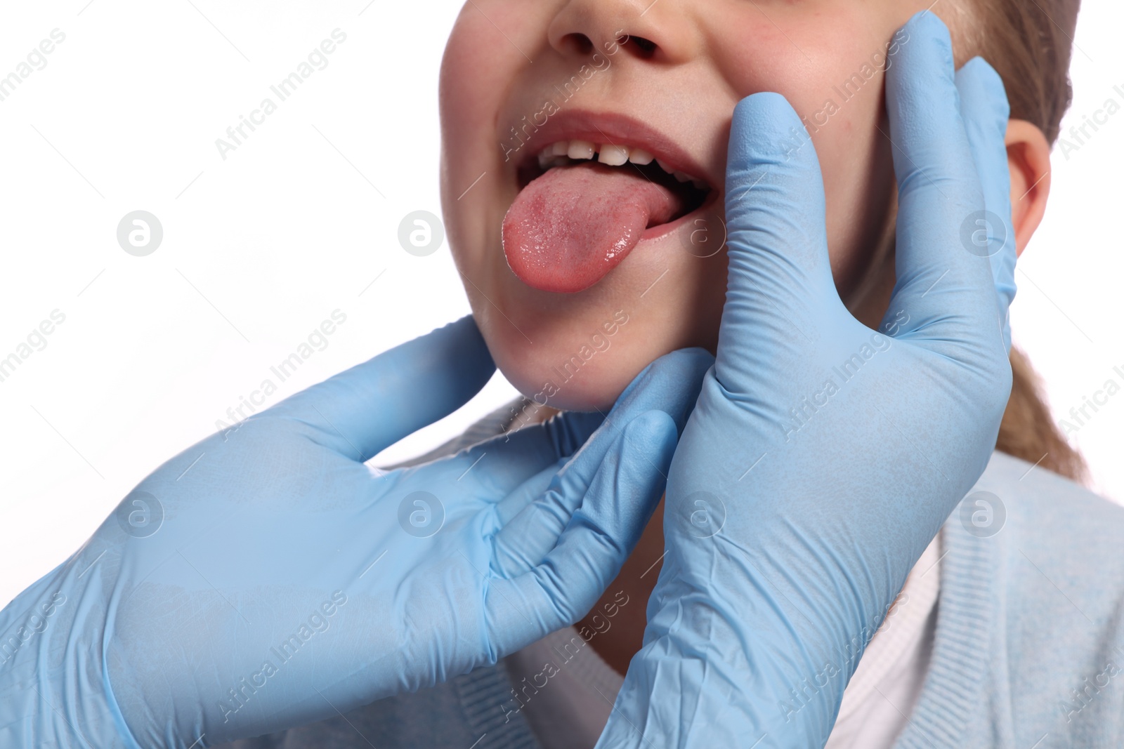 Photo of Doctor examining girl`s oral cavity on white background, closeup