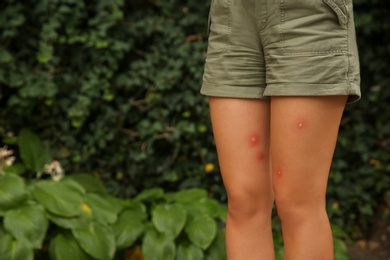 Photo of Woman with insect bites on legs in park, closeup. Space for text