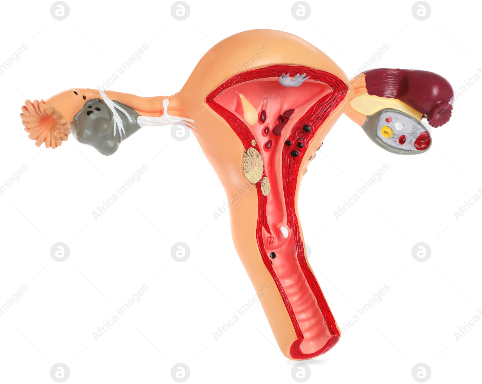 Photo of Model of female reproductive system isolated on white. Gynecological care