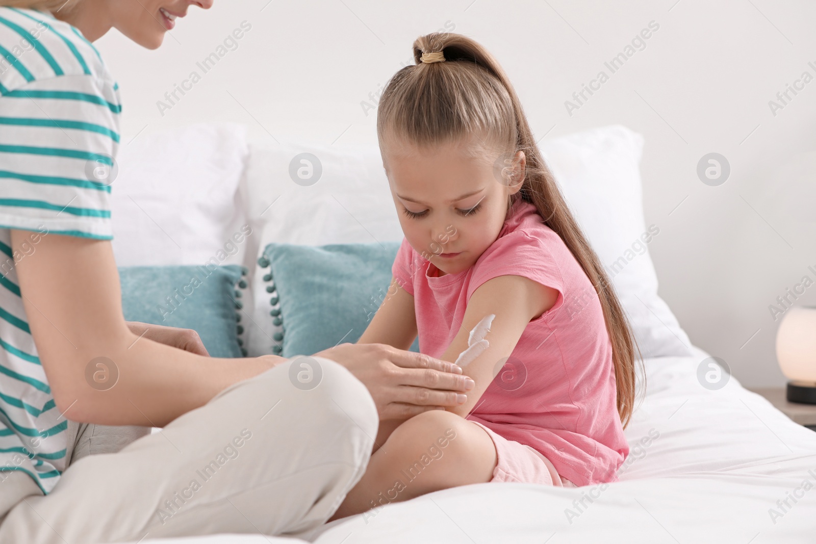 Photo of Mother applying ointment onto her daughter's hand on bed