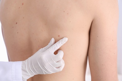 Photo of Dermatologist examining patient in clinic, closeup view